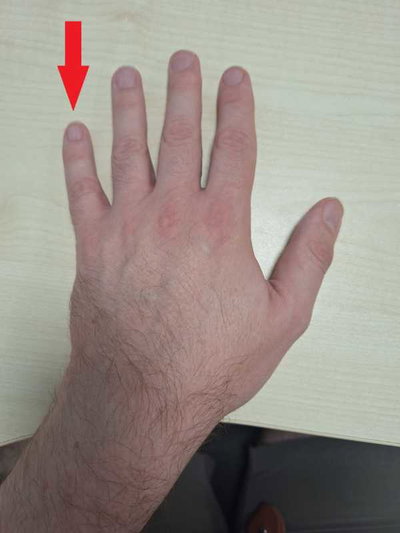 Thematic Hands: Fingers and Thumbs