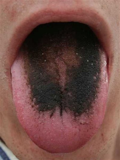 Biology: Tongue in Cheek